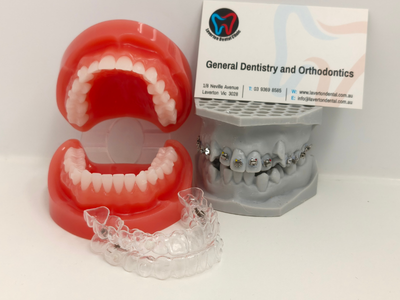 service-1-1 orthodontics and clear aligners laverton